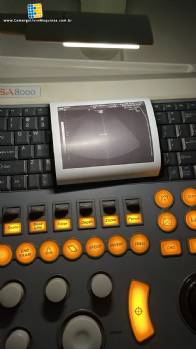 Aparelho de ultrassonografia Medison Sansung